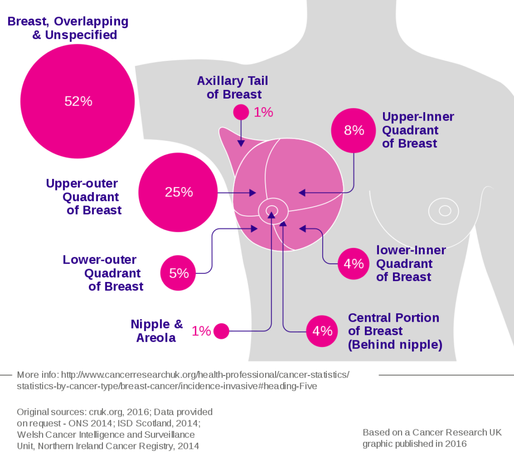 dealing-with-stress-and-breast-cancer-negative-stress