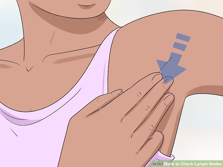 Can Stress Cause Swollen Lymph Nodes in the Armpit?